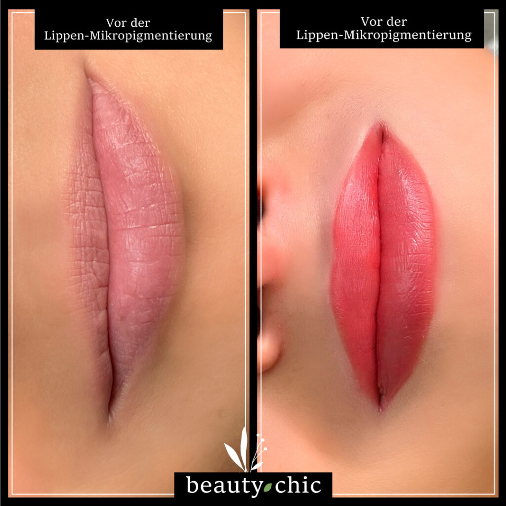 ¿Qué es la Micropigmentación?