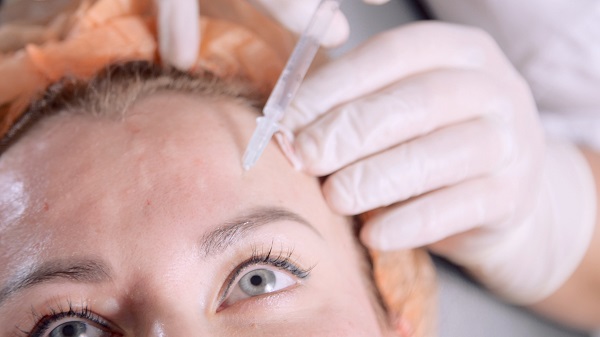 Microneedling: ¿Qué Es y Para Qué Sirve