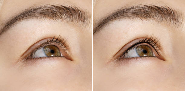 Explora los fundamentos de la micropigmentación, enfocándose en la línea superior