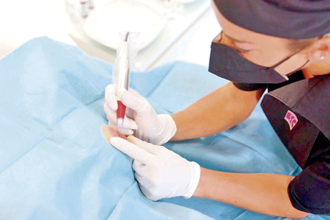 ¿Qué es la Micropigmentación Paramédica de Areolas?